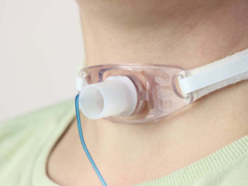 Tracheostomy Care